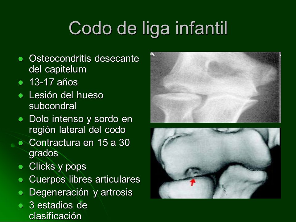 La osteocondrosis me duele sheynyy la espalda que hacer
